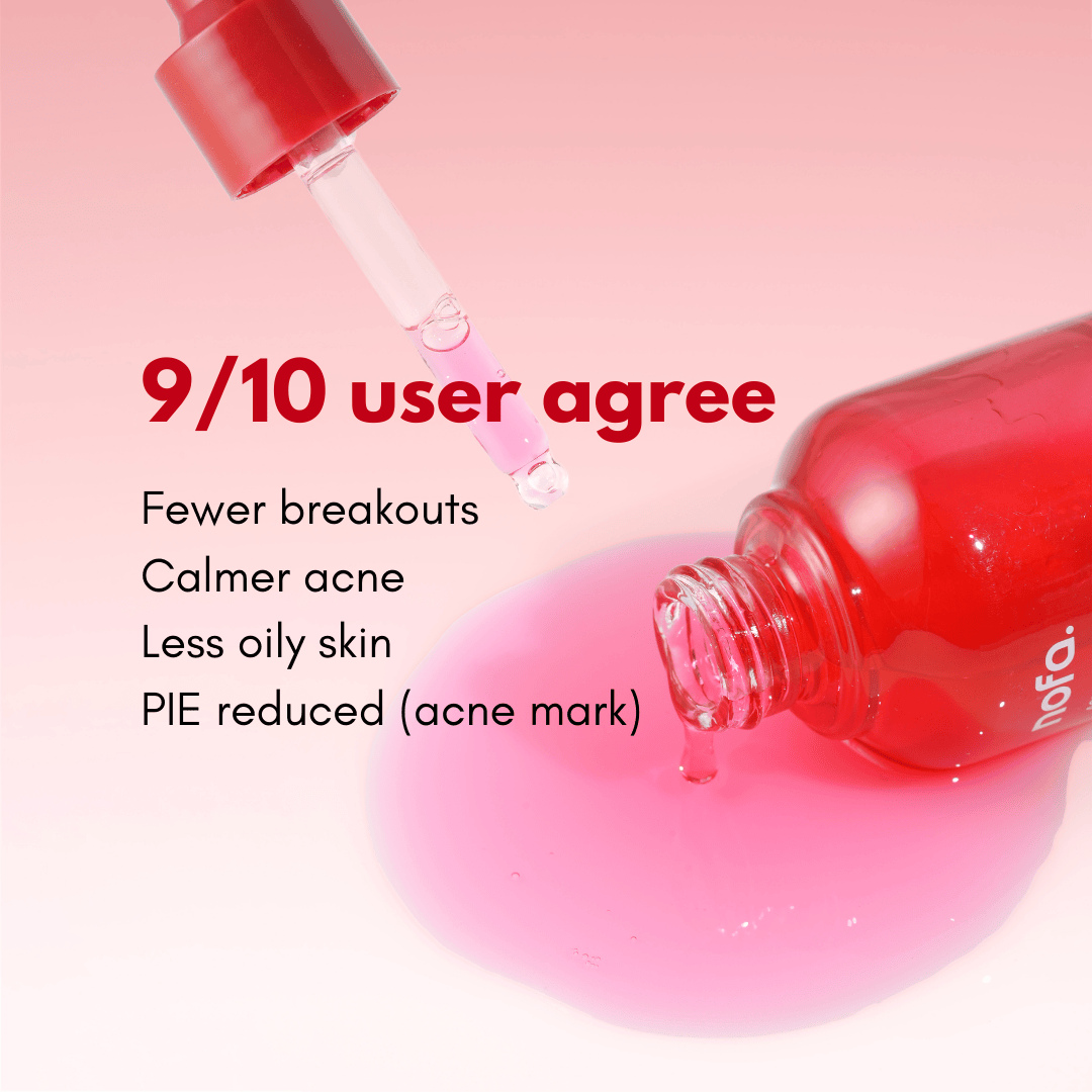 Acne Clear Rescue Serum 30ml - Image 5