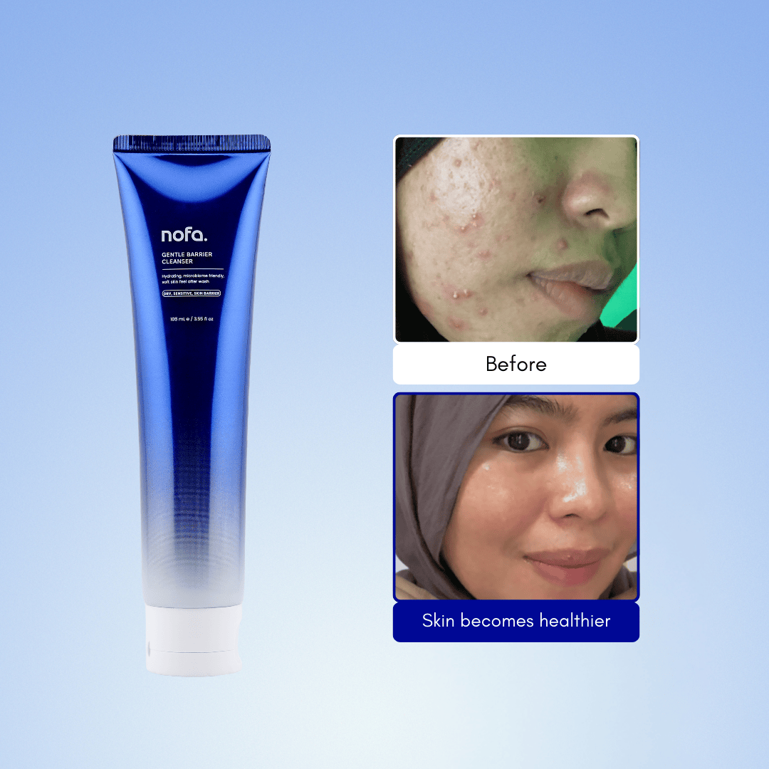 Prebiotic Gentle Barrier Cleanser 105ml - Image 6