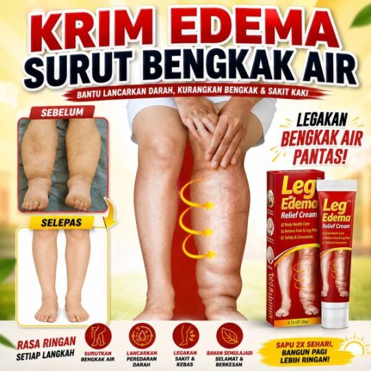 KRIM EDEMA SURUT BENGKAK AIR