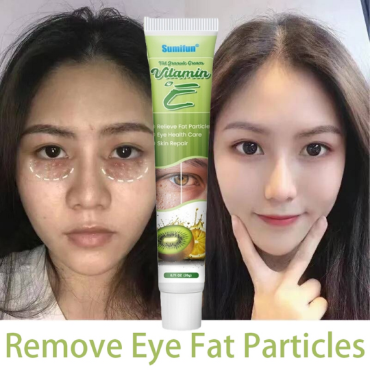 ?New Formula? EYE MILIA REMOVAL CREAM - RM39 ONLY LAST DAY PROMOTION!