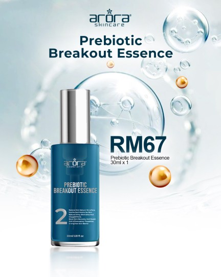 Prebiotic Breakout Essence untuk Masalah Jerawat