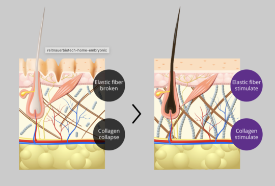 REVIVAL Embryonic Stem Cell (RESC) REPAIR &  REGENERATE