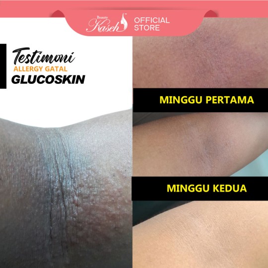 Glucoskin Moisturising Lotion